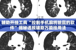 辅助开挂工具“控制手机麻将输赢的软件”揭秘透视辅助万能挂用法