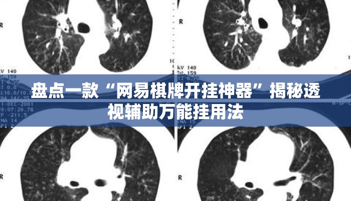 盘点一款“网易棋牌开挂神器”揭秘透视辅助万能挂用法